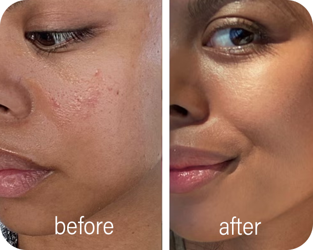 Glokore LED Mask visible skincare improvement